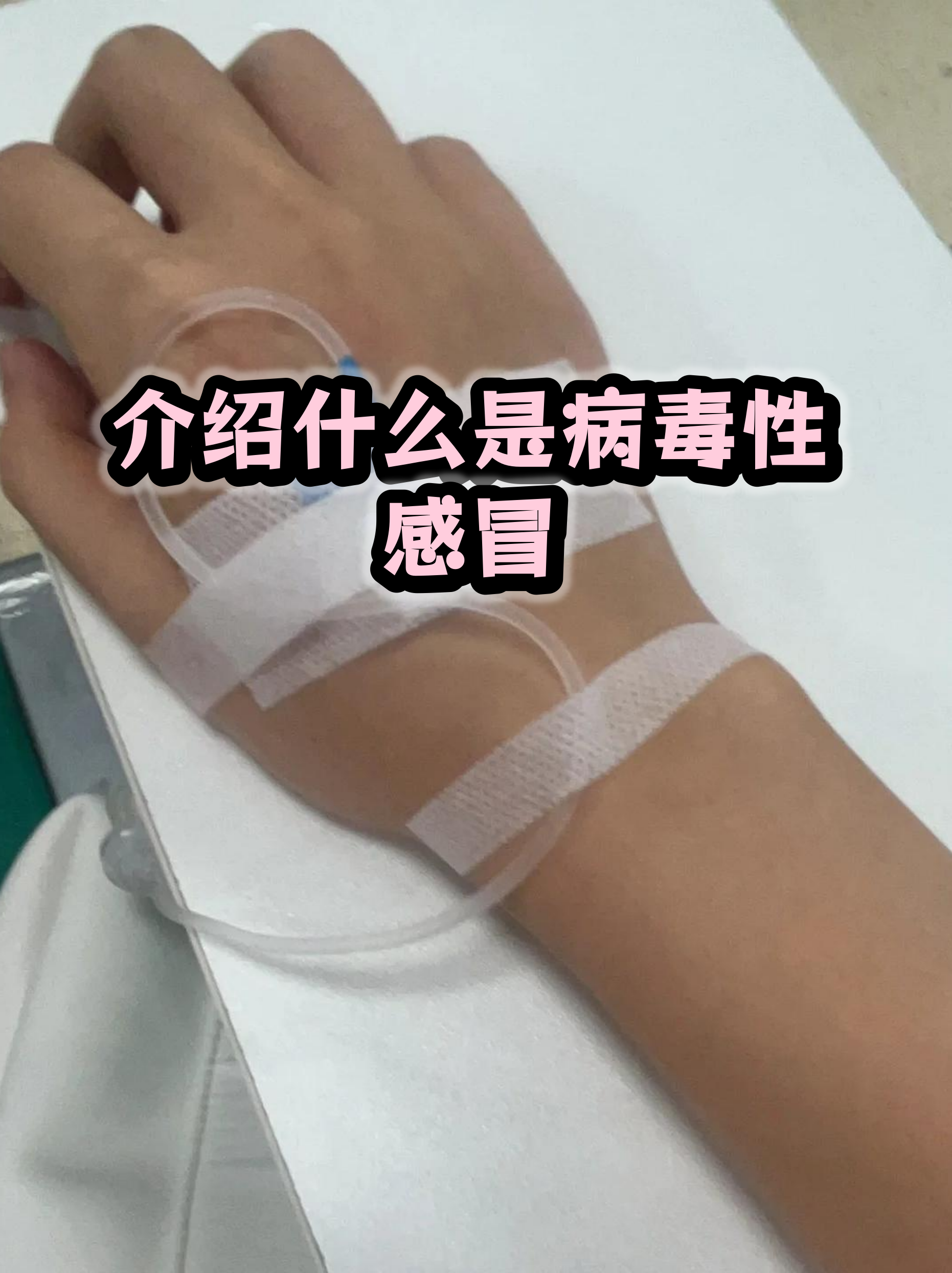江苏病毒.江苏病毒性感冒