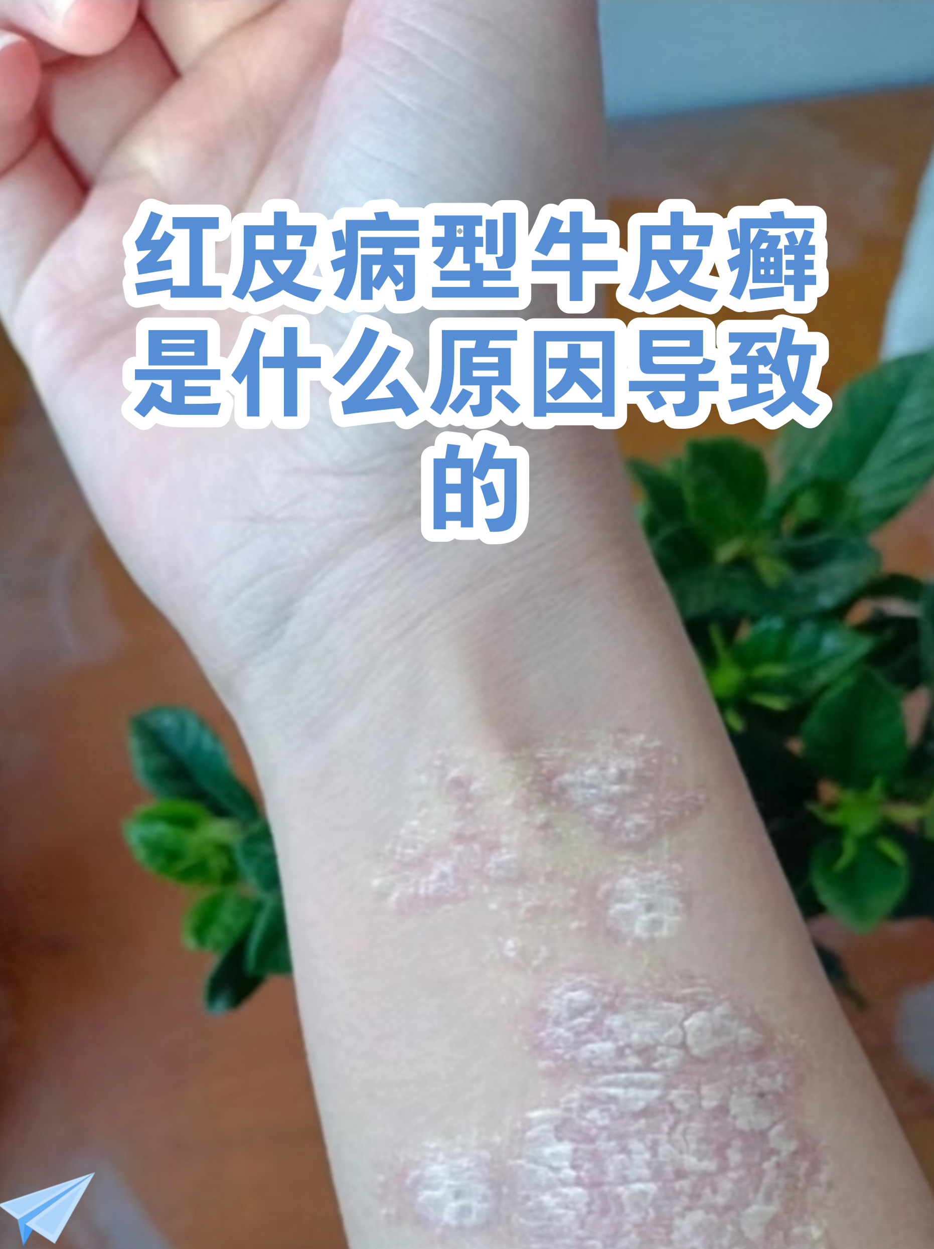 “最新病毒感染2019	” 最新病毒感染什么症状？-第3张图片