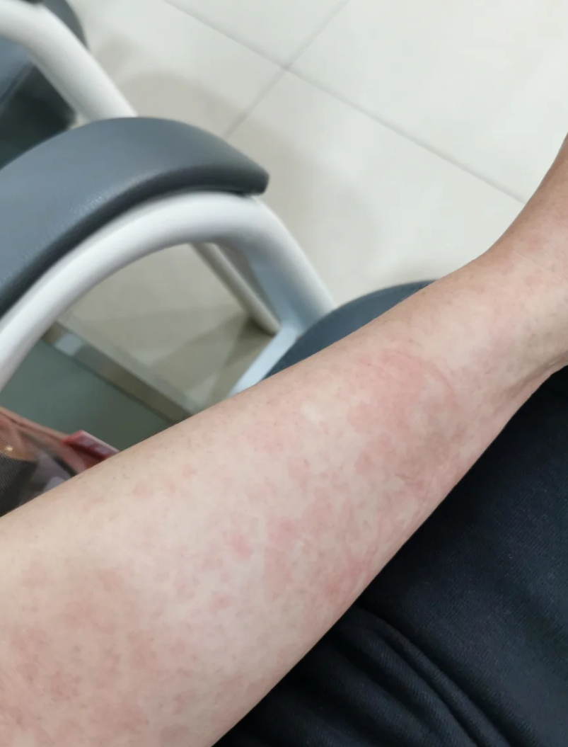 “最新病毒感染2019” 最新病毒感染什么症状？-第2张图片