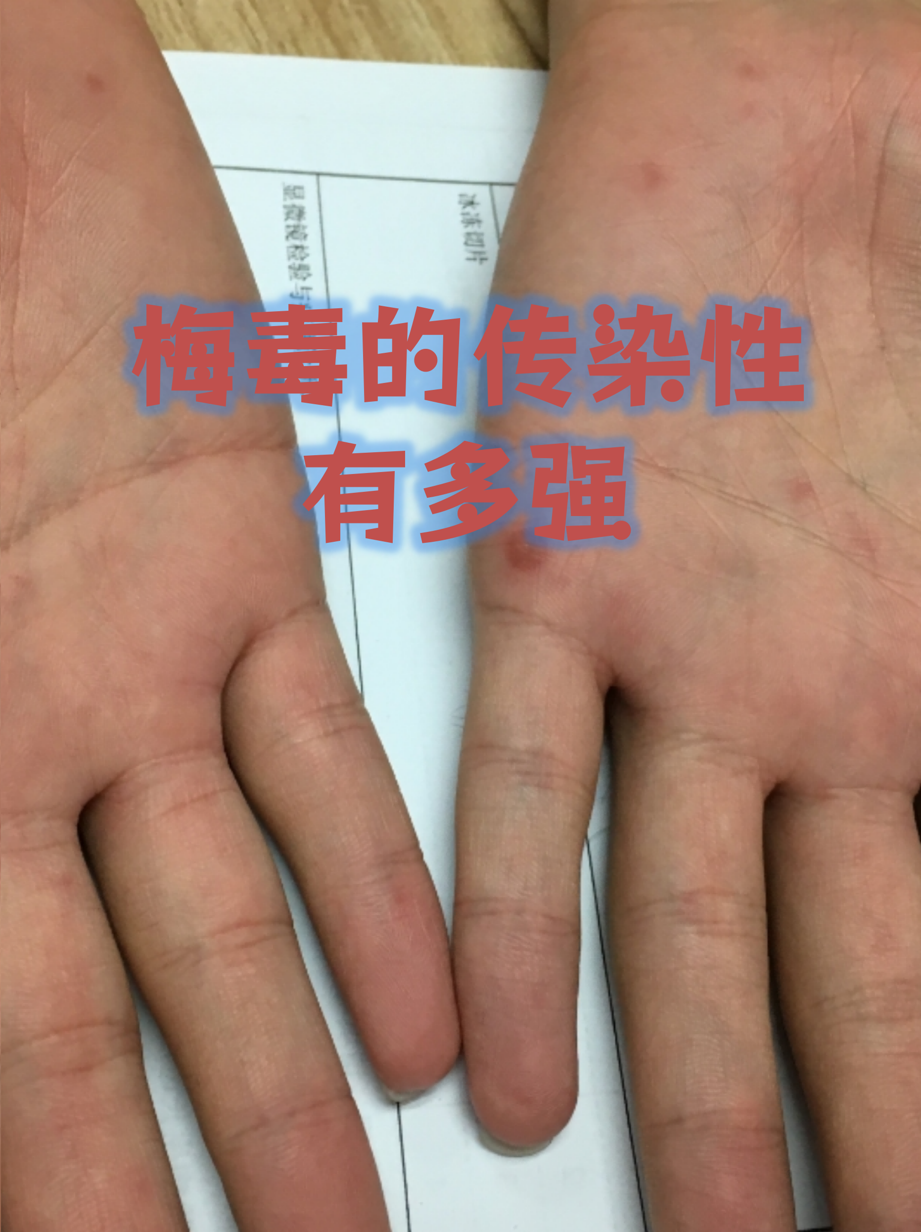 “北京本起疫情初判传播风险高” 北京疫情现超级传播？-第3张图片