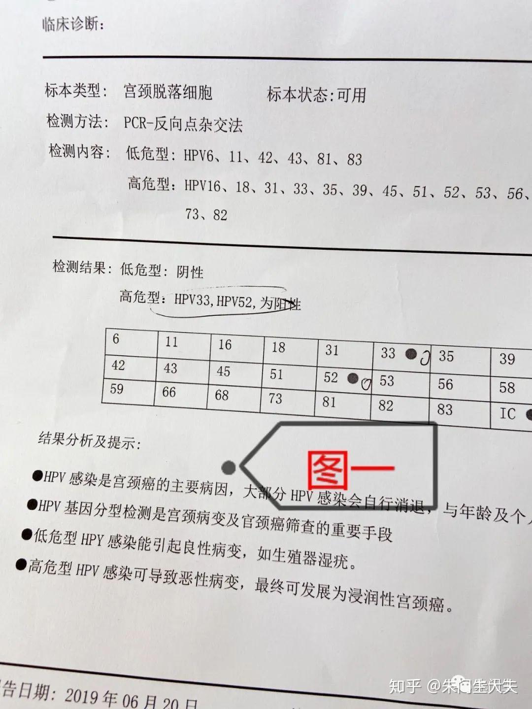 沈阳一号病例.网传沈阳1号病例-第3张图片
