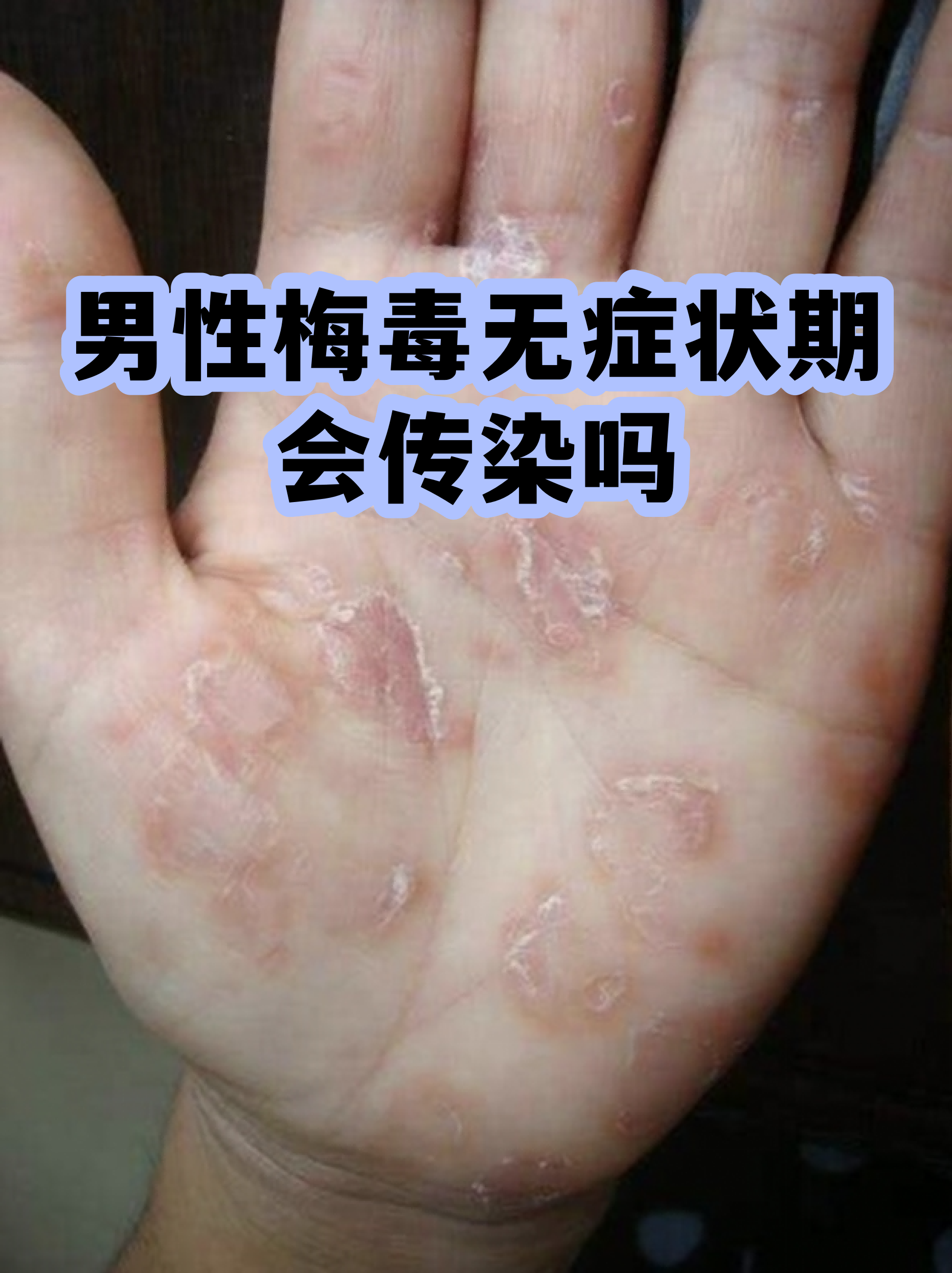 “四川无症状感染者” 四川 无症状？-第2张图片
